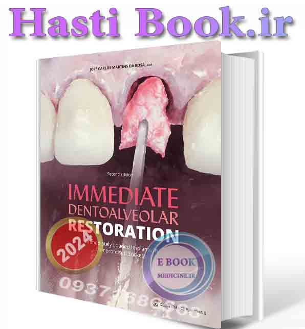 دانلود کتاب Immediate Dentoalveolar Restoration: Immediately Loaded Implants in Compromised Sockets, 2nd Edition 2024 ( PDF)