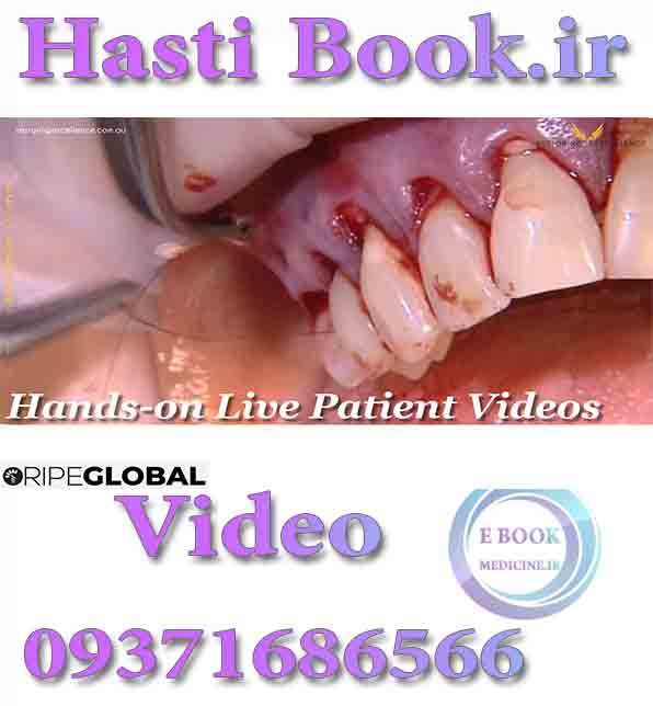 فیلم video RipeGlobal Hands-on Live Patients Video Collection (2)