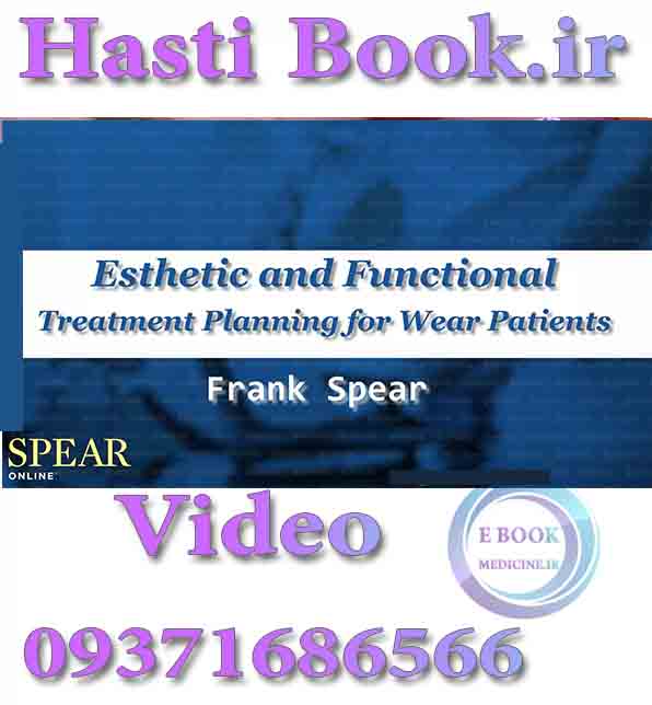 فیلم video SPEAR Esthetic and Functional Treatment Planning for Wear Patients - Frank Spear (2)