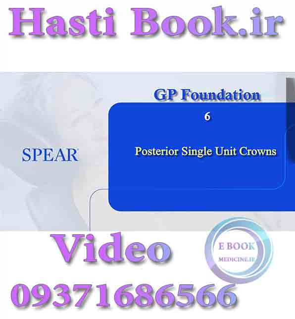 فیلم video  SPEAR GP Foundation 6, Posterior Single Unit Crowns (2)