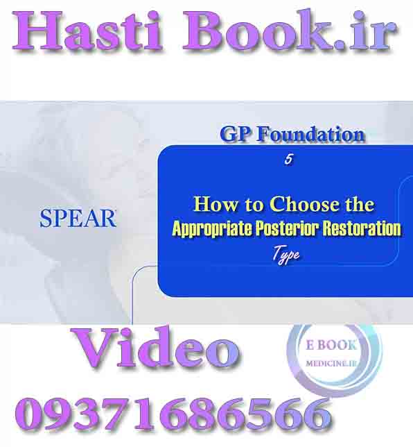 فیلم video SPEAR GP Foundation 5, How to Choose the Appropriate Posterior Restoration Type (2)
