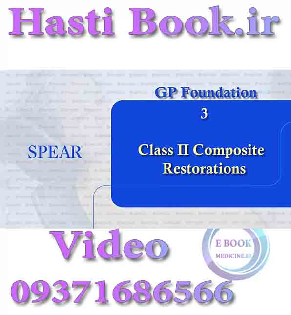 فیلم SPEAR GP Foundation 3, Class II Composite Restorations (2)