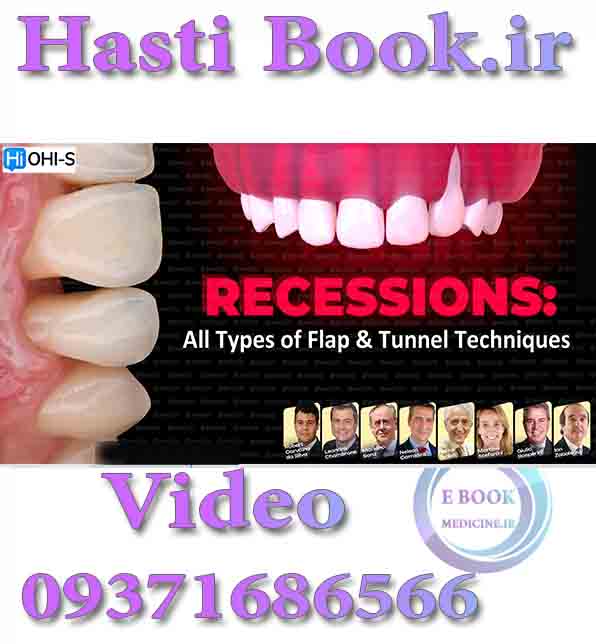 فیلم OHI-S Recessions All Types of Flap & Tunnel Techniques