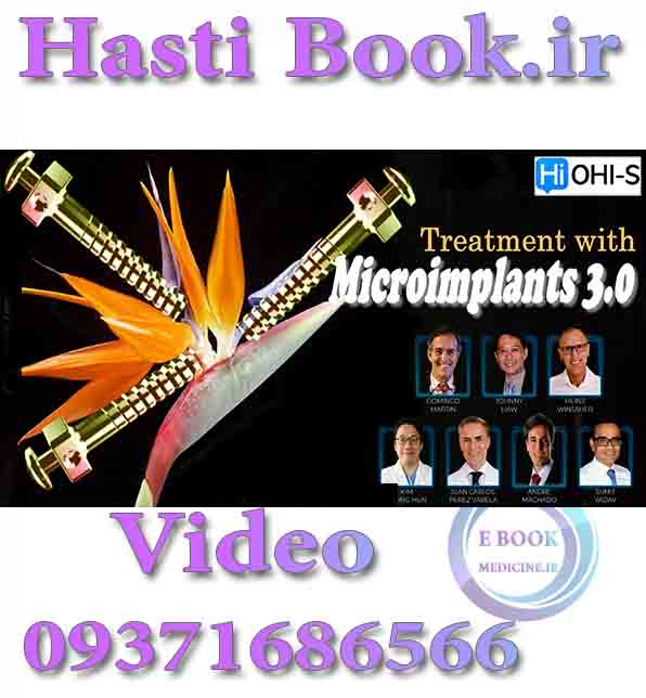 فیلم  OHI-S Treatment with Mcroimplants 3.0 (2)