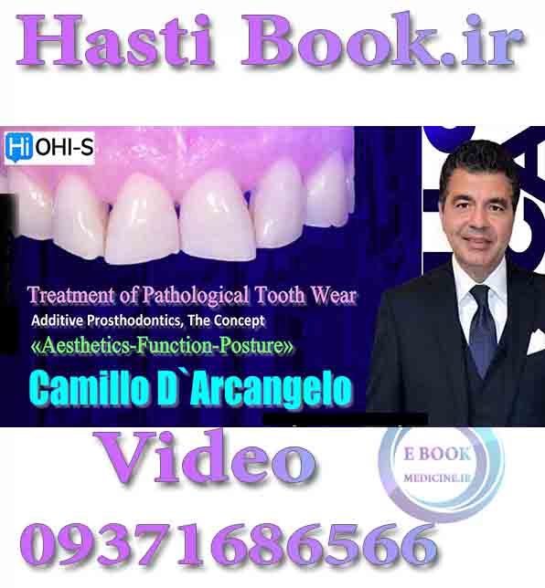 فیلم OHI-S Treatment of Pathological Tooth Wear - Camillo D`ArcangeloAdditive Prosthodontics. The Concept «Aesthetics-Function-Posture» (2)