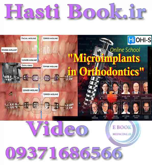فیلم OHI-S Online School Microimplants in Orthodontics (2)