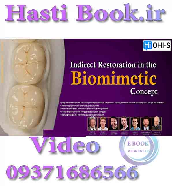 فیلم  OHI-S Indirect Restoration in the Biomimetic Concept (2)