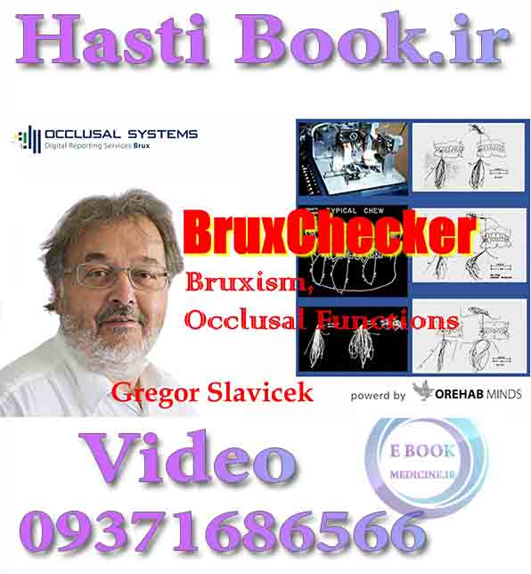 فیلم OCLUSYS BruxChecker, Bruxism, Occlusal Functions - Gregor Slavicek (2)