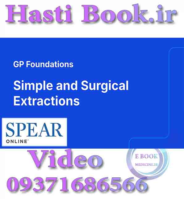 فیلم SPEAR Simple and Surgical Extraction (2)