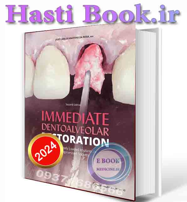 دانلود کتاب Immediate Dentoalveolar Restoration: Immediately Loaded Implants in Compromised Sockets, 2nd Edition 2024 (scan PDF)