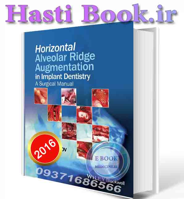 دانلود کتاب Horizontal Alveolar Ridge Augmentation in Implant Dentistry: A Surgical Manual   (ORIGINAL PDF)
