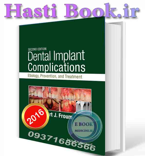 دانلود کتاب Dental Implant Complications: Etiology, Prevention, and Treatment   (ORIGINAL PDF)