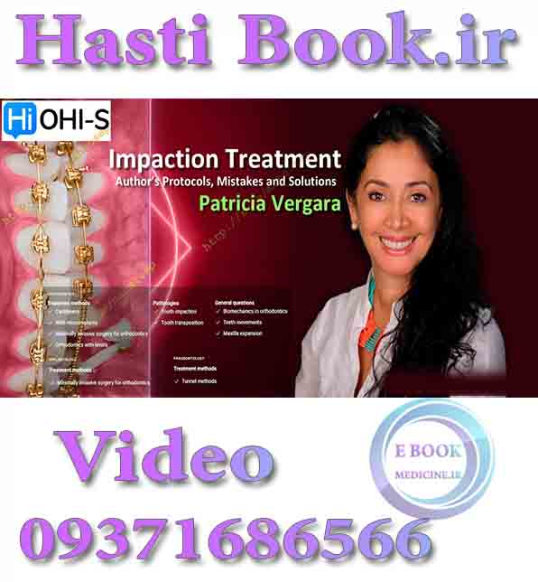 فیلم  Impaction Treatment. Author’s Protocols, Mistakes and Solutions - Patricia Vergara video (2)