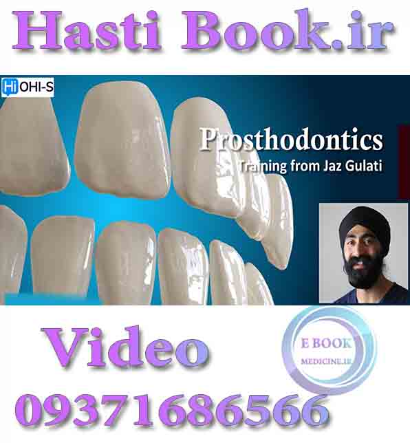 فیلم  OHI-S Prosthodontics Training from Jazz Gulati video (2)