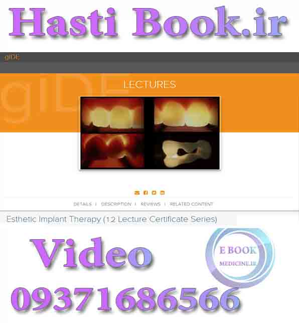 فیلم gIDE Esthetic Implant Therapy  (12 Lecture Certificate Series) video (2)