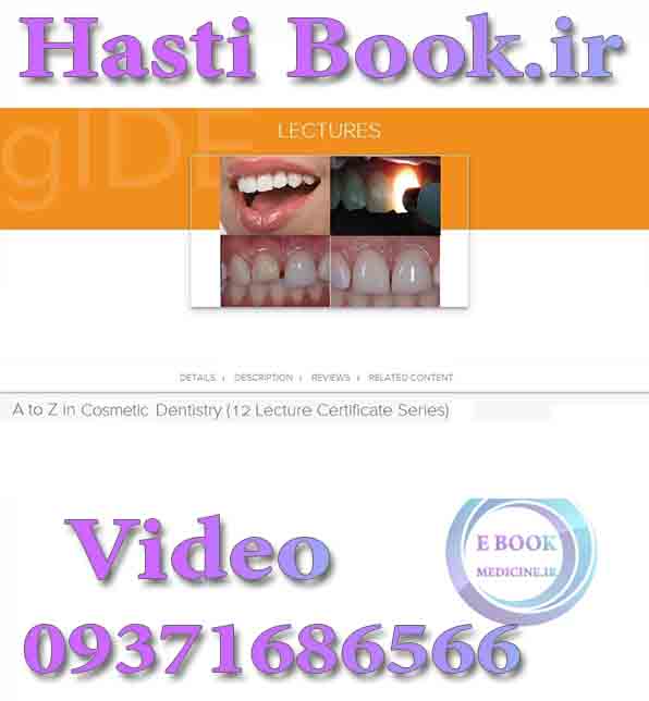فیلم gIDE A to Z in Cosmetic Dentistry  (12 Lecture Certificate Series) video (2)