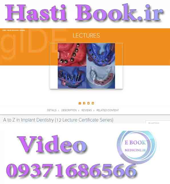 فیلم gIDE A to Z in Implant Dentistry (Videos) (2)