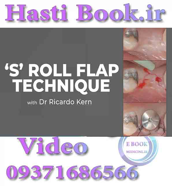 دانلودفیلم  The “S” Roll Flap Technique - Ricardo Kern (video) .