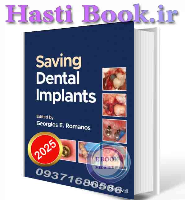 دانلود کتاب Saving Dental Implants 2024 (ORIGINAL PDF)