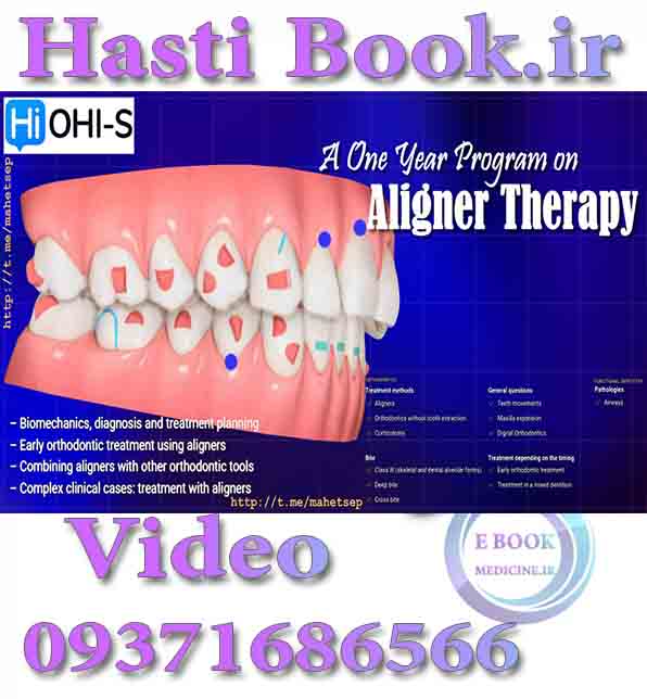 دانلودفیلم  OHI-S A One Year Program on Aligner Therapy (video) .