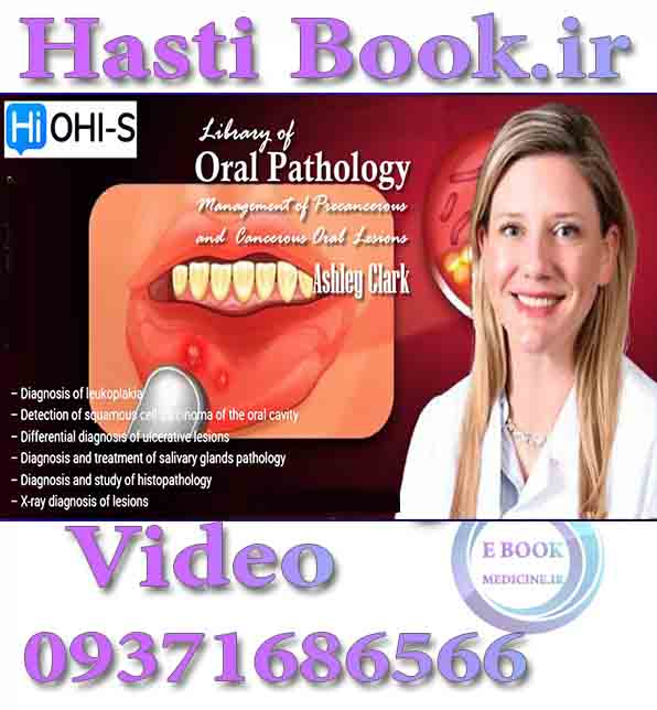 دانلودفیلم OHI-S Library of Oral Pathology - Ashley Clark Management of Precancerous and Cancerous Oral Lesions (video) .