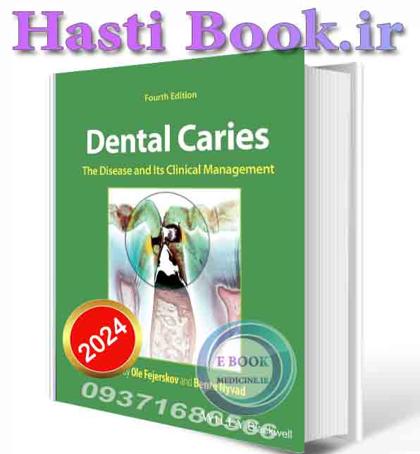 دانلود کتاب Dental Caries: The Disease and its Clinical Management 2024 (ORIGINAL PDF)
